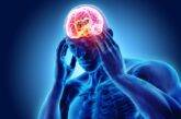 Understand the migraine headaches
